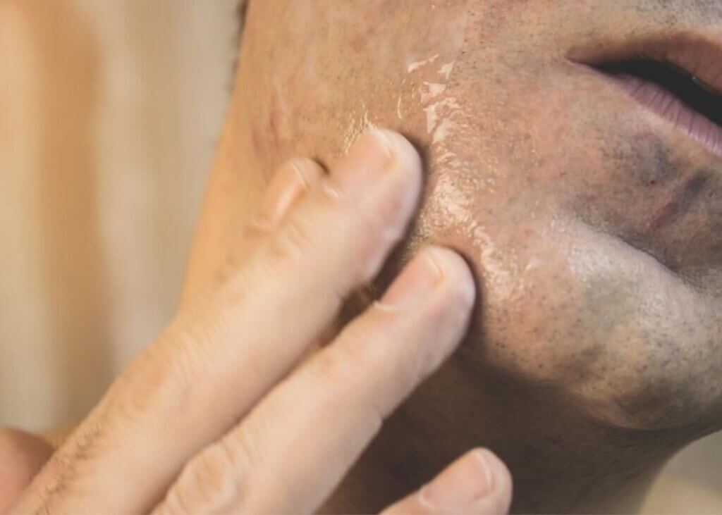 ヒゲ脱毛開始19ヶ月。実験的に3ヶ月間治療を中断して得た気づき