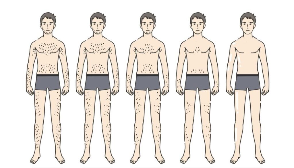早速始めよう。QOLとエチケットのための40代男性脱毛のすすめ