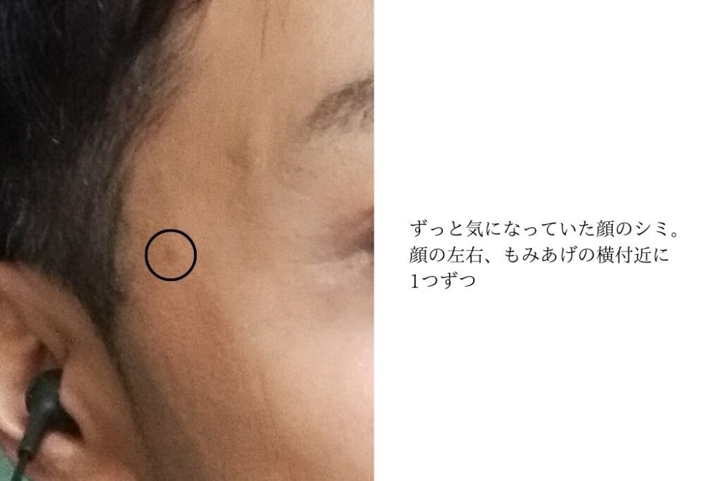 美的コンプレックス放置は人生の時間の無駄遣い