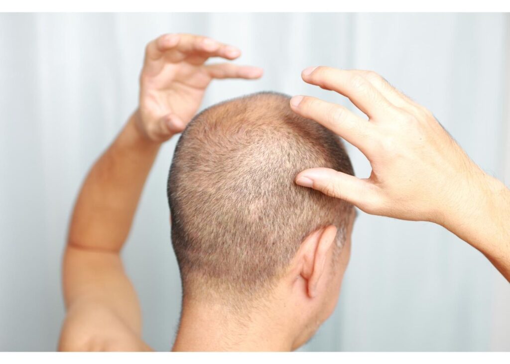40歳からのエイジングケア(メンズヘアケア編)