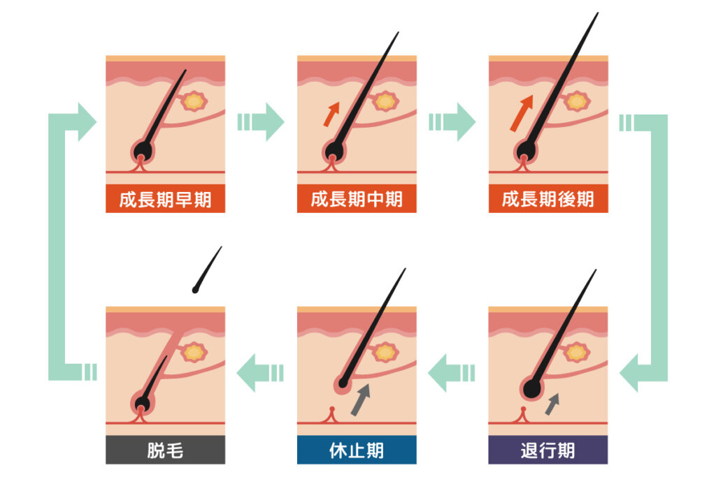 初めてのメンズVIO脱毛。検討している方への10のアドバイス