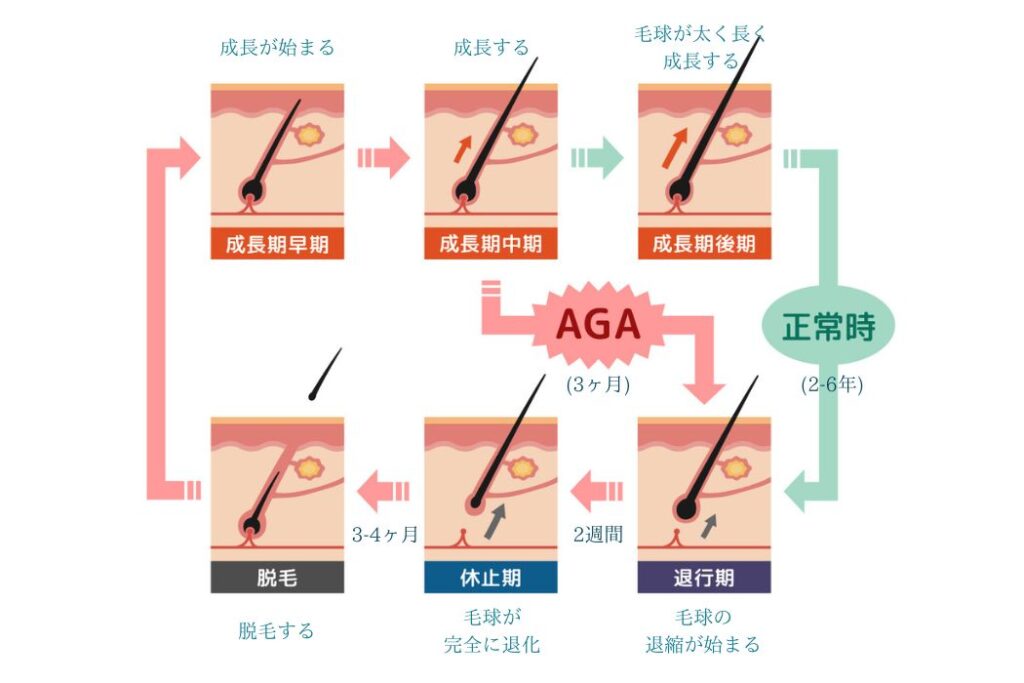 本気で薄毛を治す。オンライン完結のAGAクリニックおすすめ6選(FAGA含む)