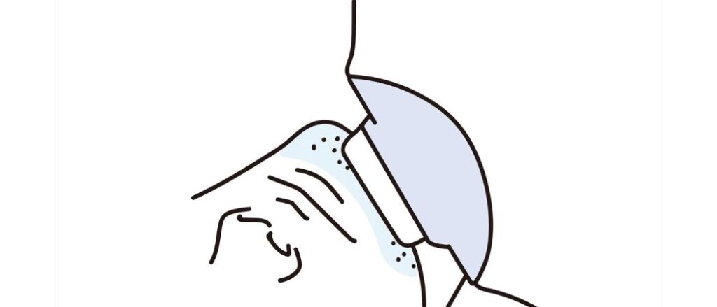 メンズ脱毛のリアル。全身脱毛歴1年の私が脱毛効果や感想を話します