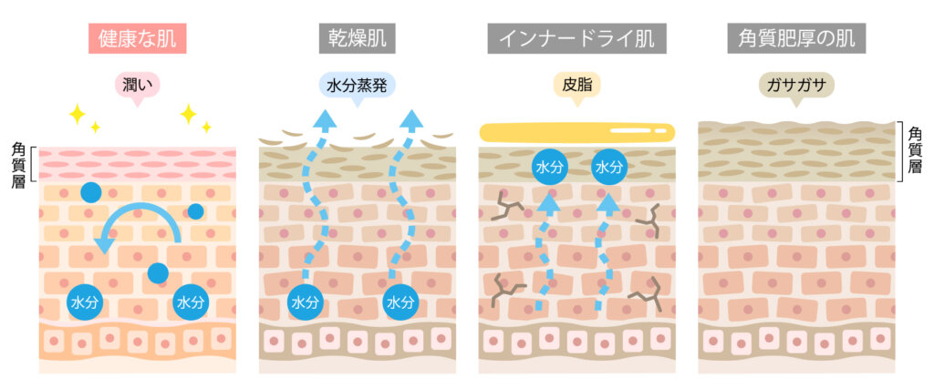 乾燥・油性・混合肌に。80％が加水分解コラーゲン発酵液エキスの混合肌化粧液