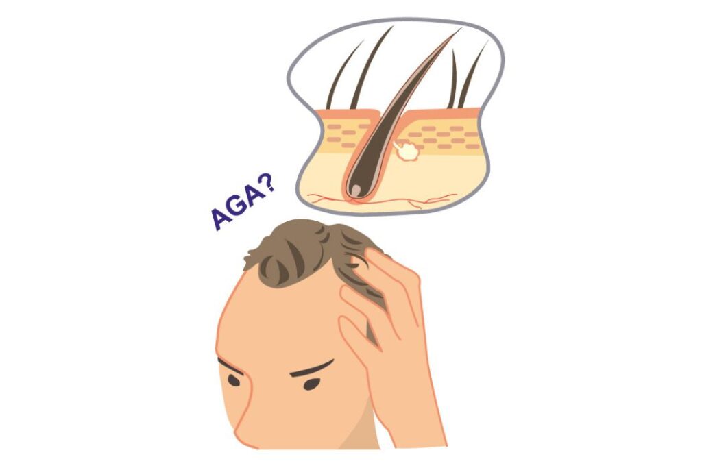 本気で薄毛を治す。オンライン完結のAGAクリニックおすすめ6選(FAGA含む)