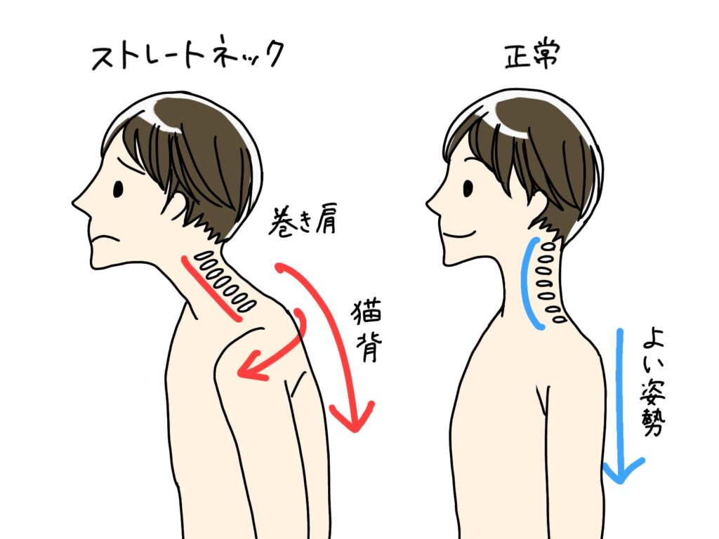 整体効果・ストレートネック改善を叶える"すごい整体枕" (#1.キュアレ)